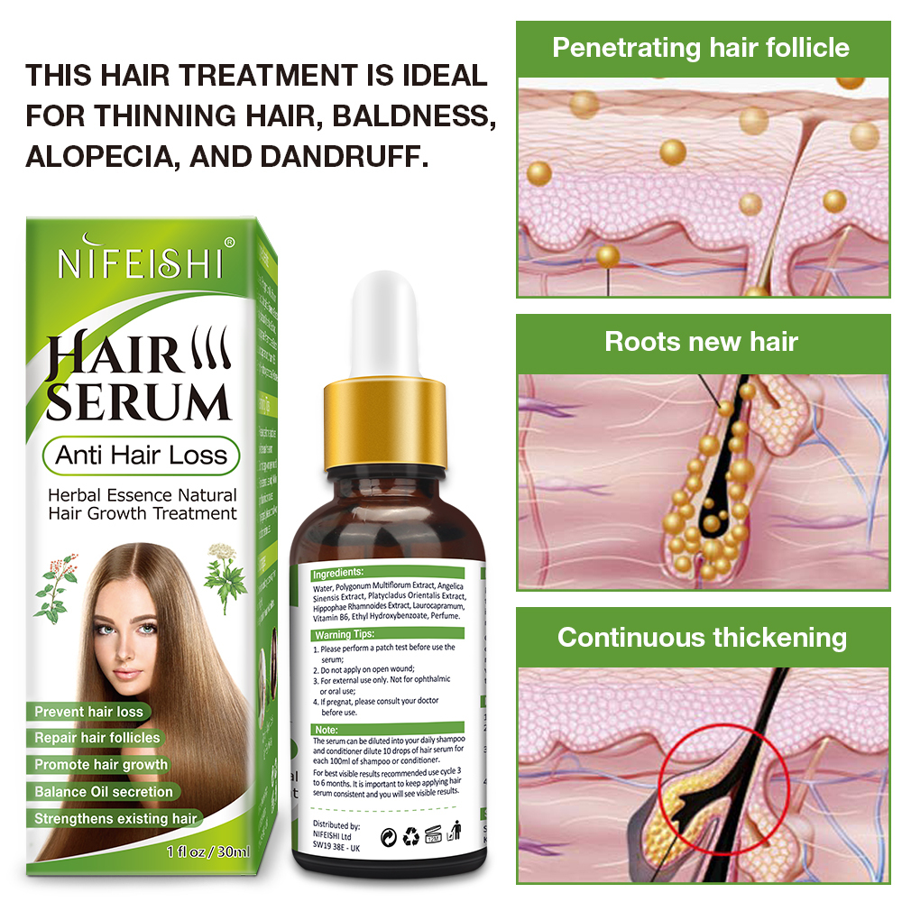 Nifeishi Natural Hair Serum Anti Hair Loss Growth Oil Treatment Woman ...