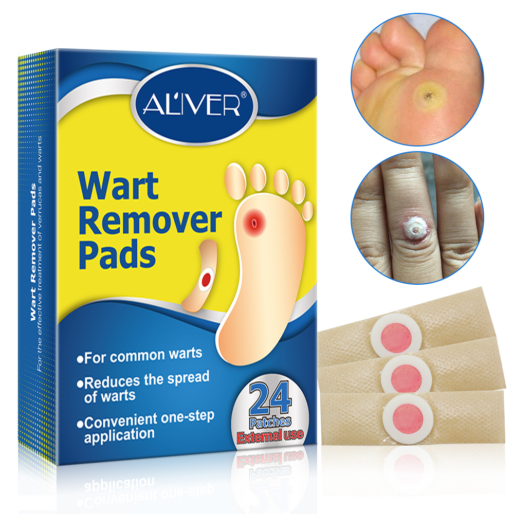 Plantar wart pads Idea