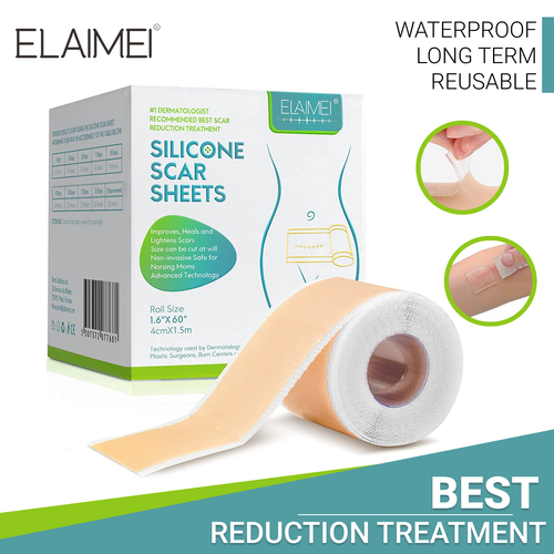 Elaimei Silicone Scar Sheets Gel Patches Removal Tape Skin Repair Wound Treatment Roll, 1.5M